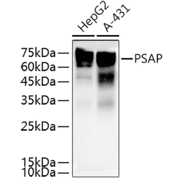 Western Blot - Anti-PSAP Antibody (A13679) - Antibodies.com