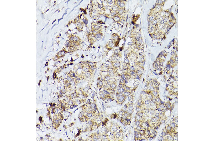 Immunohistochemistry - Anti-PSAP Antibody (A13679) - Antibodies.com