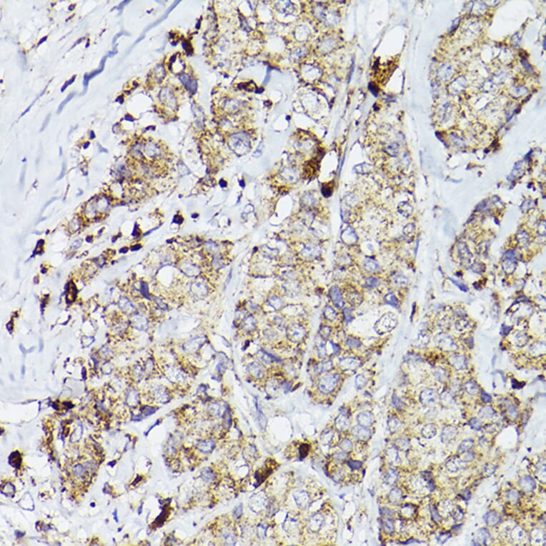 Immunohistochemistry - Anti-PSAP Antibody (A13679) - Antibodies.com