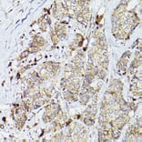 Immunohistochemistry - Anti-PSAP Antibody (A13679) - Antibodies.com