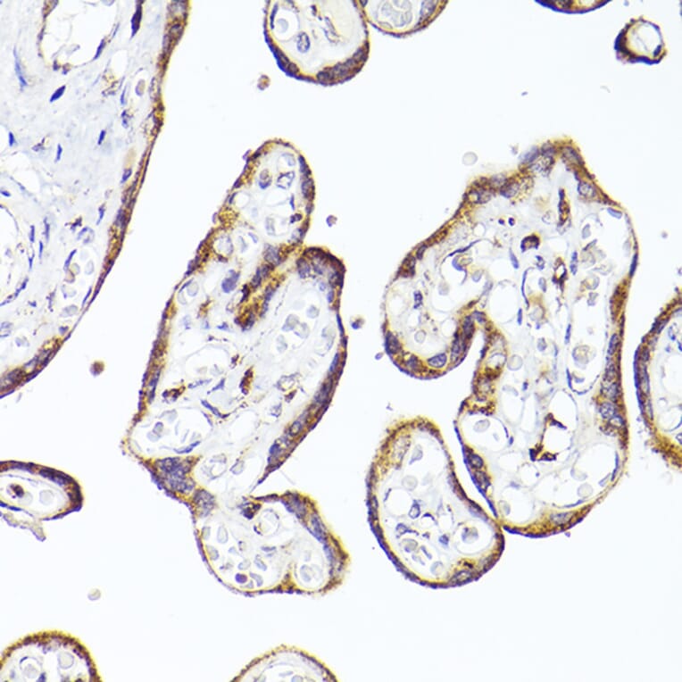 Immunohistochemistry - Anti-PSAP Antibody (A13679) - Antibodies.com