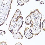 Immunohistochemistry - Anti-PSAP Antibody (A13679) - Antibodies.com