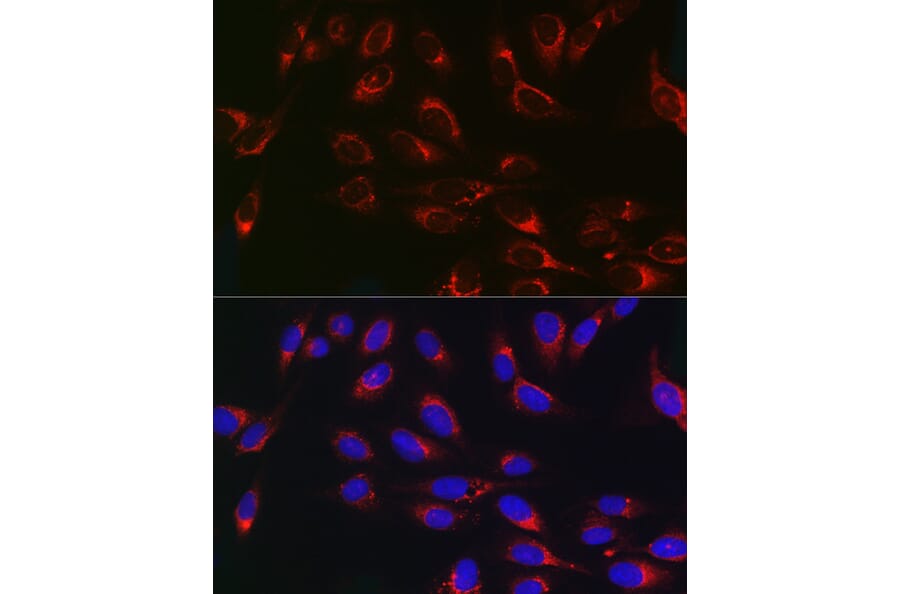 Immunofluorescence - Anti-PSAP Antibody (A13679) - Antibodies.com