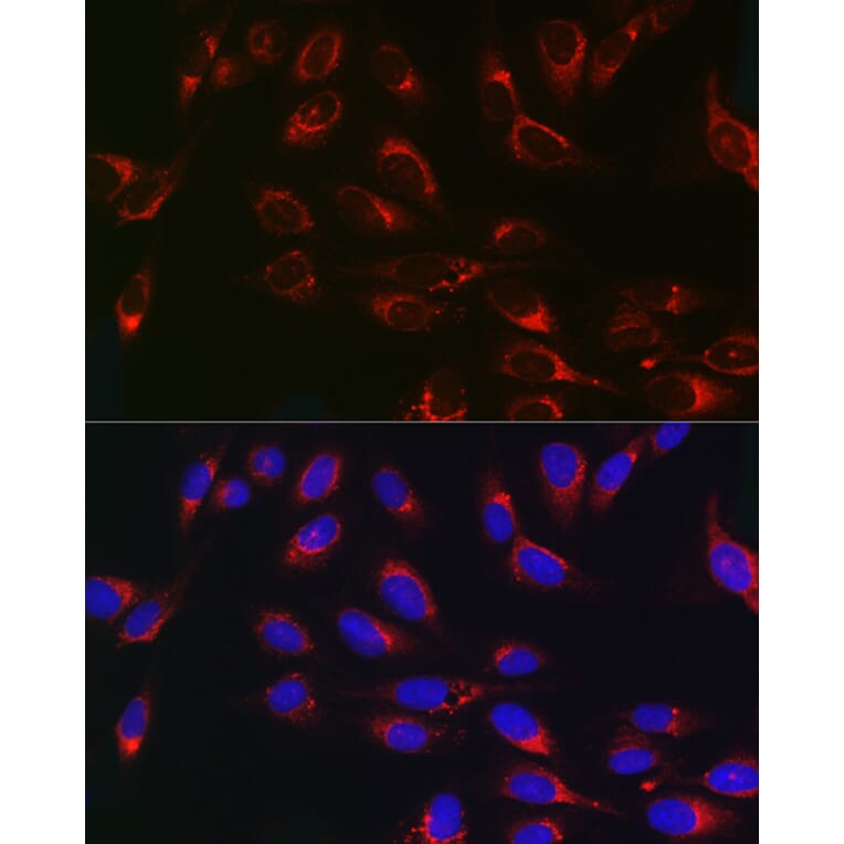 Immunofluorescence - Anti-PSAP Antibody (A13679) - Antibodies.com