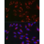 Immunofluorescence - Anti-PSAP Antibody (A13679) - Antibodies.com