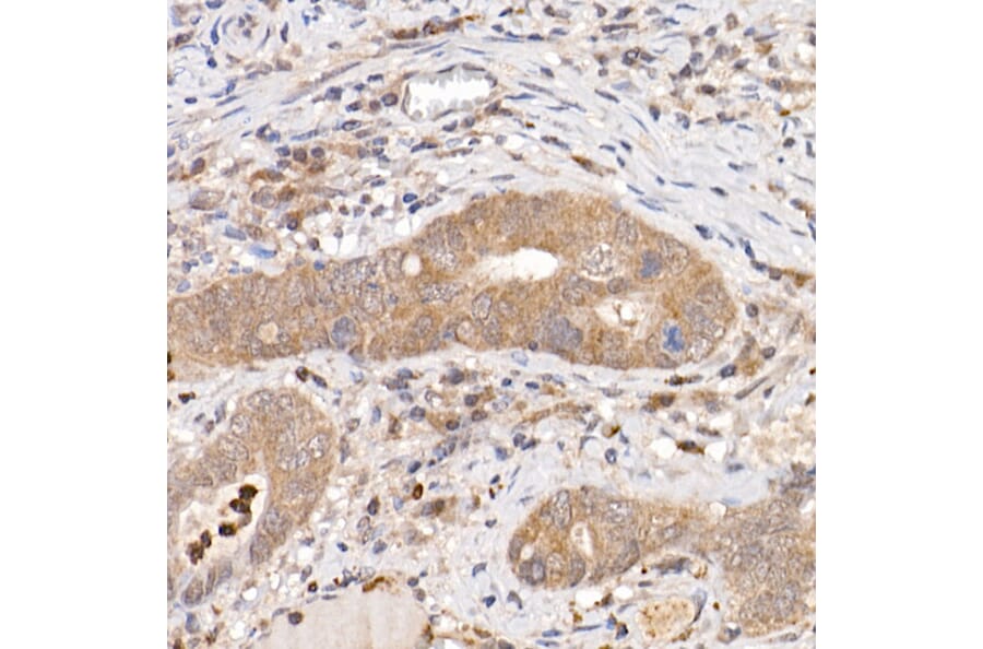 Immunohistochemistry - Anti-Keap1 Antibody (A13680) - Antibodies.com