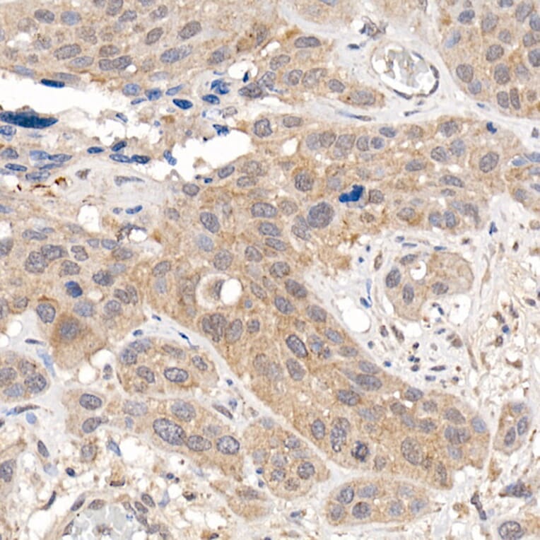 Immunohistochemistry - Anti-Keap1 Antibody (A13680) - Antibodies.com