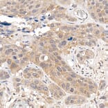 Immunohistochemistry - Anti-Keap1 Antibody (A13680) - Antibodies.com