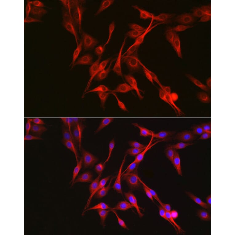 Immunofluorescence - Anti-Keap1 Antibody (A13680) - Antibodies.com