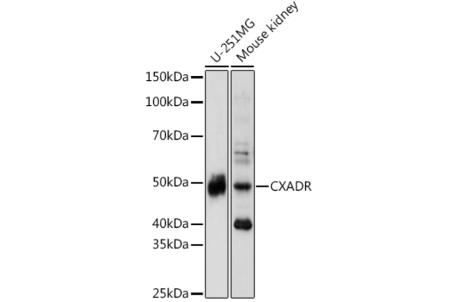 Western Blot - Anti-Coxsackie Adenovirus Receptor/hCAR Antibody (A13681) - Antibodies.com
