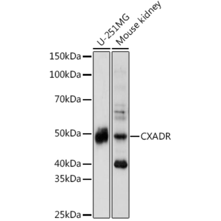 Western Blot - Anti-Coxsackie Adenovirus Receptor/hCAR Antibody (A13681) - Antibodies.com