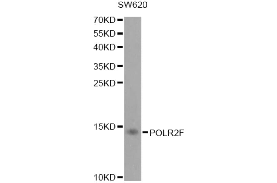 Western Blot - Anti-POLR2F Antibody (A1824) - Antibodies.com