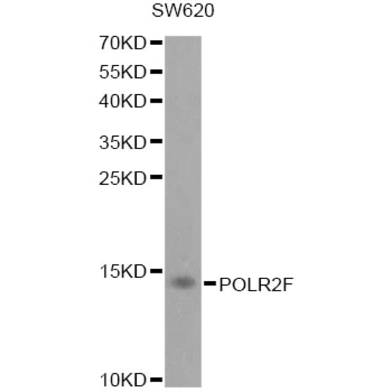 Western Blot - Anti-POLR2F Antibody (A1824) - Antibodies.com