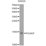 Western Blot - Anti-POLR2F Antibody (A1824) - Antibodies.com