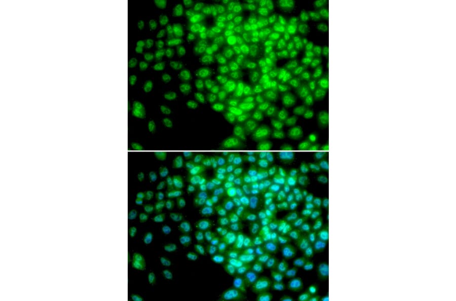Immunofluorescence - Anti-POLR2F Antibody (A1824) - Antibodies.com