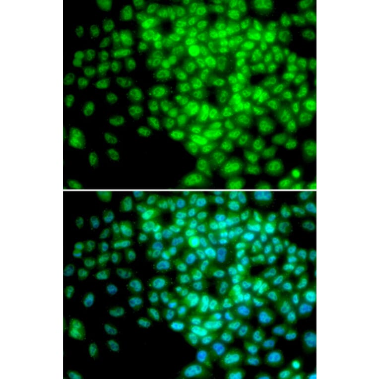 Immunofluorescence - Anti-POLR2F Antibody (A1824) - Antibodies.com