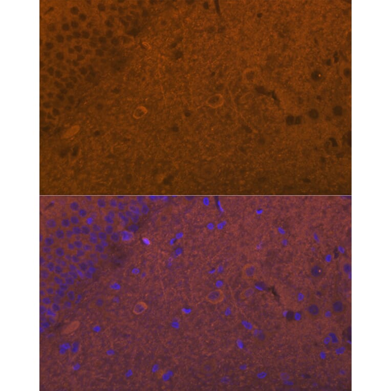 Immunofluorescence - Anti-Glutamate Receptor 1 (AMPA subtype) Antibody (A13683) - Antibodies.com