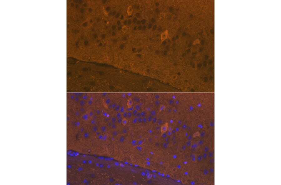 Immunofluorescence - Anti-Glutamate Receptor 1 (AMPA subtype) Antibody (A13683) - Antibodies.com