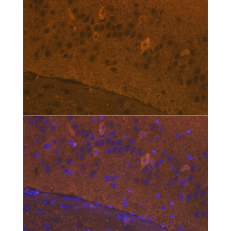 Immunofluorescence - Anti-Glutamate Receptor 1 (AMPA subtype) Antibody (A13683) - Antibodies.com