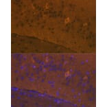 Immunofluorescence - Anti-Glutamate Receptor 1 (AMPA subtype) Antibody (A13683) - Antibodies.com