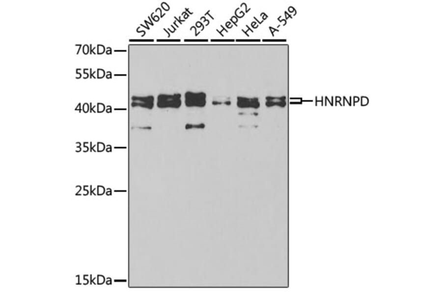 Western Blot - Anti-hnRNP D/AUF1 Antibody (A13684) - Antibodies.com