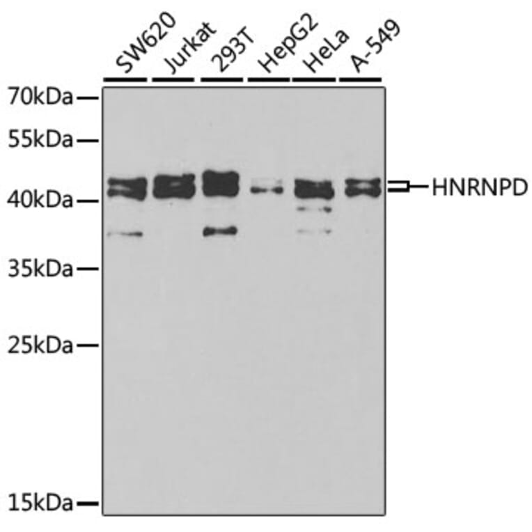 Western Blot - Anti-hnRNP D/AUF1 Antibody (A13684) - Antibodies.com