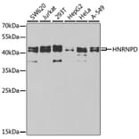 Western Blot - Anti-hnRNP D/AUF1 Antibody (A13684) - Antibodies.com