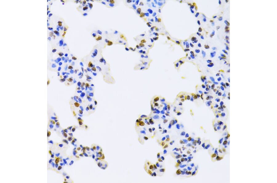 Immunohistochemistry - Anti-hnRNP D/AUF1 Antibody (A13684) - Antibodies.com