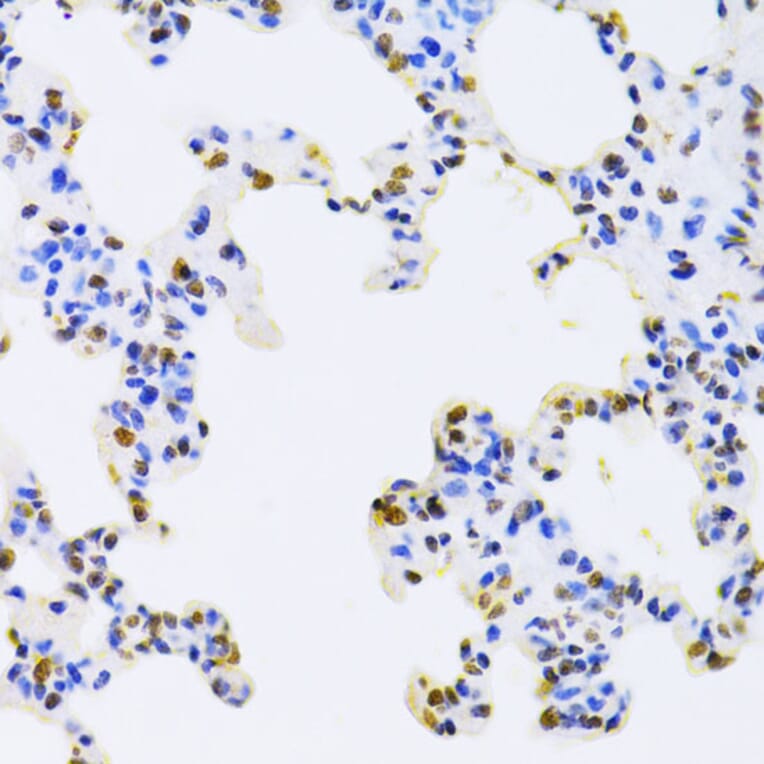 Immunohistochemistry - Anti-hnRNP D/AUF1 Antibody (A13684) - Antibodies.com