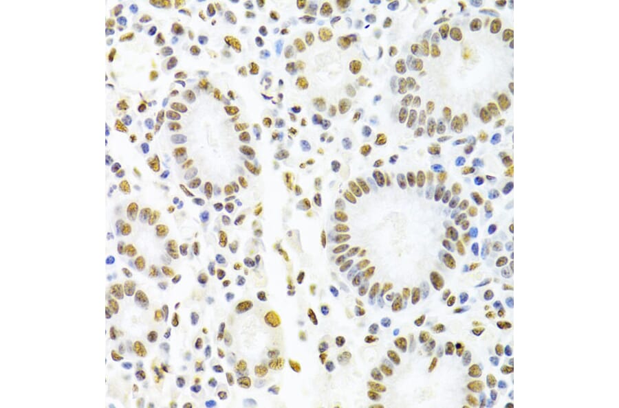 Immunohistochemistry - Anti-hnRNP D/AUF1 Antibody (A13684) - Antibodies.com