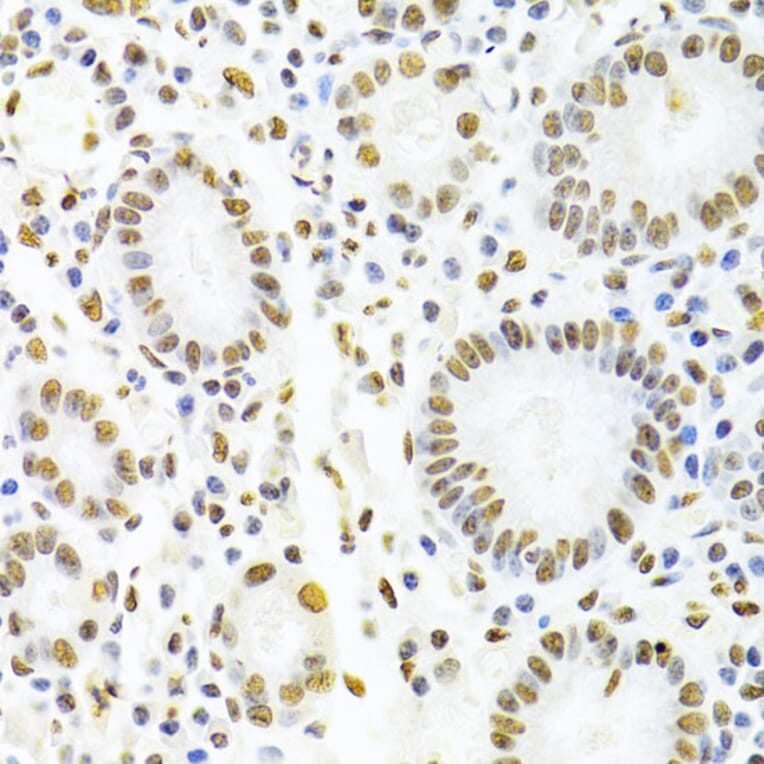 Immunohistochemistry - Anti-hnRNP D/AUF1 Antibody (A13684) - Antibodies.com
