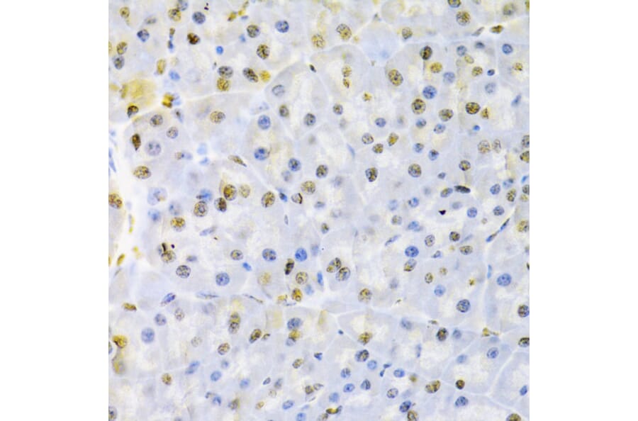 Immunohistochemistry - Anti-hnRNP D/AUF1 Antibody (A13684) - Antibodies.com