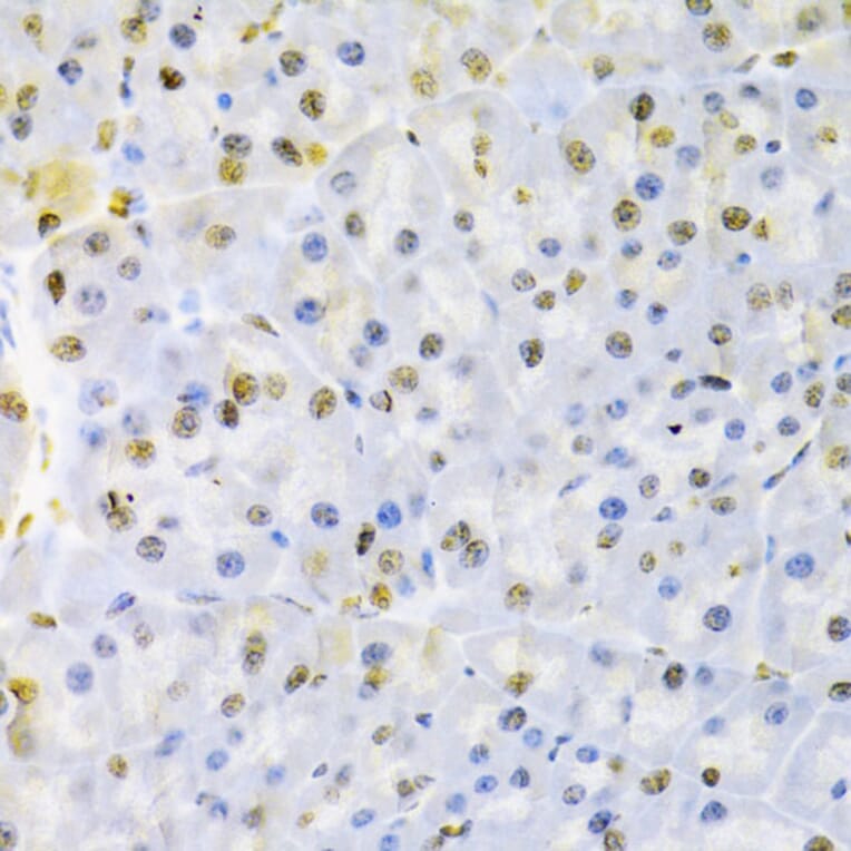 Immunohistochemistry - Anti-hnRNP D/AUF1 Antibody (A13684) - Antibodies.com