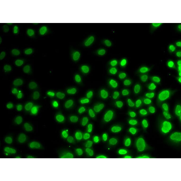Immunofluorescence - Anti-hnRNP D/AUF1 Antibody (A13684) - Antibodies.com