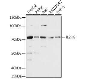 Western Blot - Anti-IL-2RG Antibody (A13685) - Antibodies.com