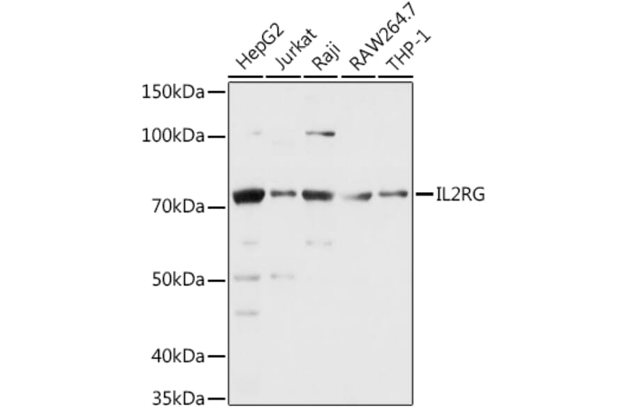 Western Blot - Anti-IL-2RG Antibody (A13685) - Antibodies.com