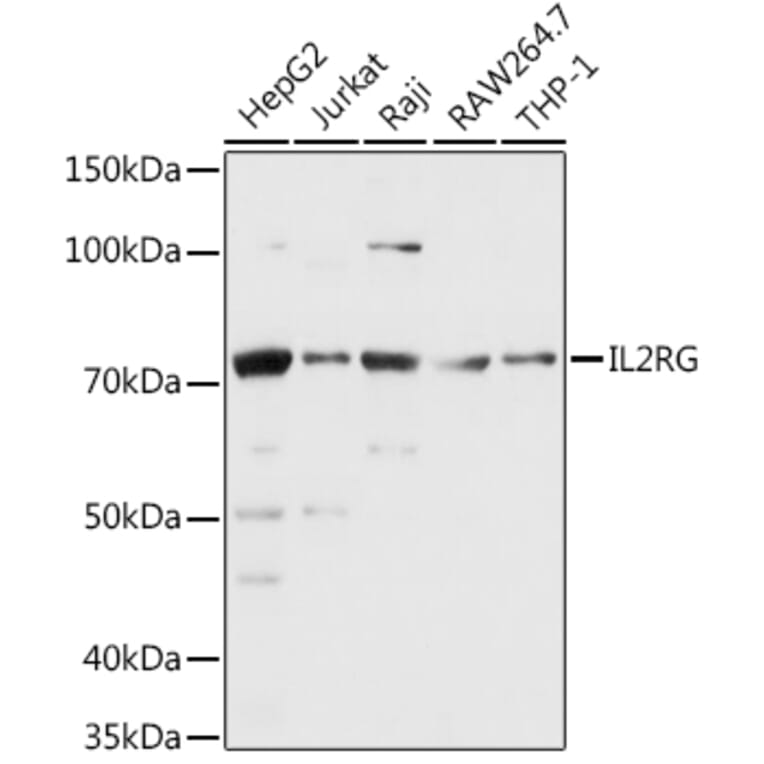 Western Blot - Anti-IL-2RG Antibody (A13685) - Antibodies.com