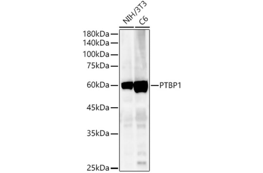 Western Blot - Anti-PTBP1 Antibody (A13686) - Antibodies.com