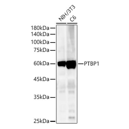 Western Blot - Anti-PTBP1 Antibody (A13686) - Antibodies.com