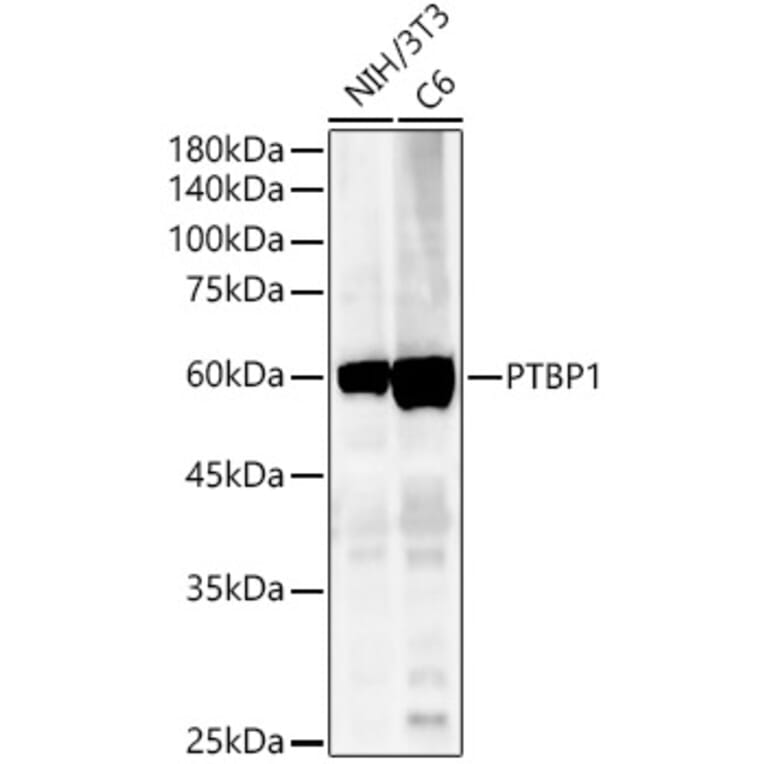 Western Blot - Anti-PTBP1 Antibody (A13686) - Antibodies.com