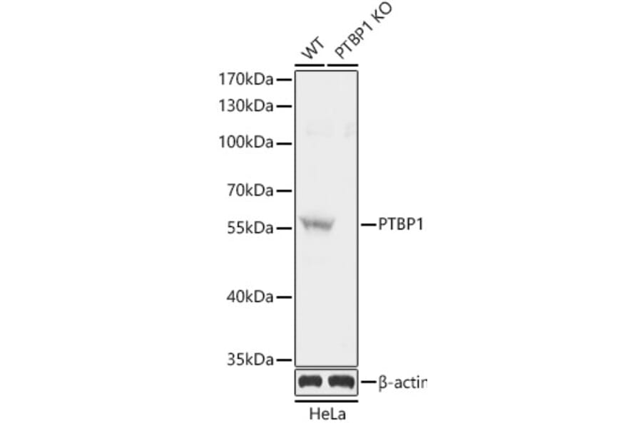Western Blot - Anti-PTBP1 Antibody (A13686) - Antibodies.com