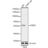 Western Blot - Anti-PTBP1 Antibody (A13686) - Antibodies.com