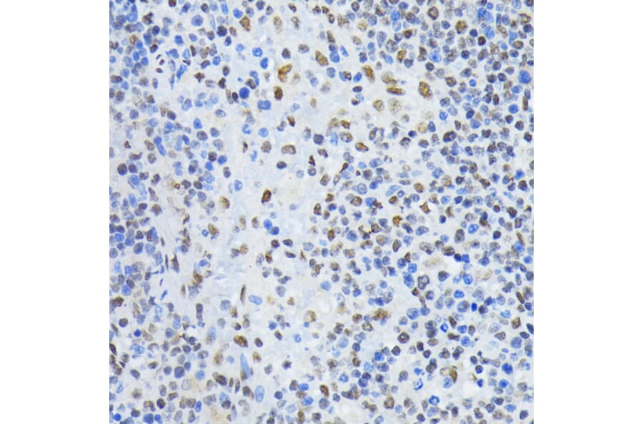 Immunohistochemistry - Anti-PTBP1 Antibody (A13686) - Antibodies.com