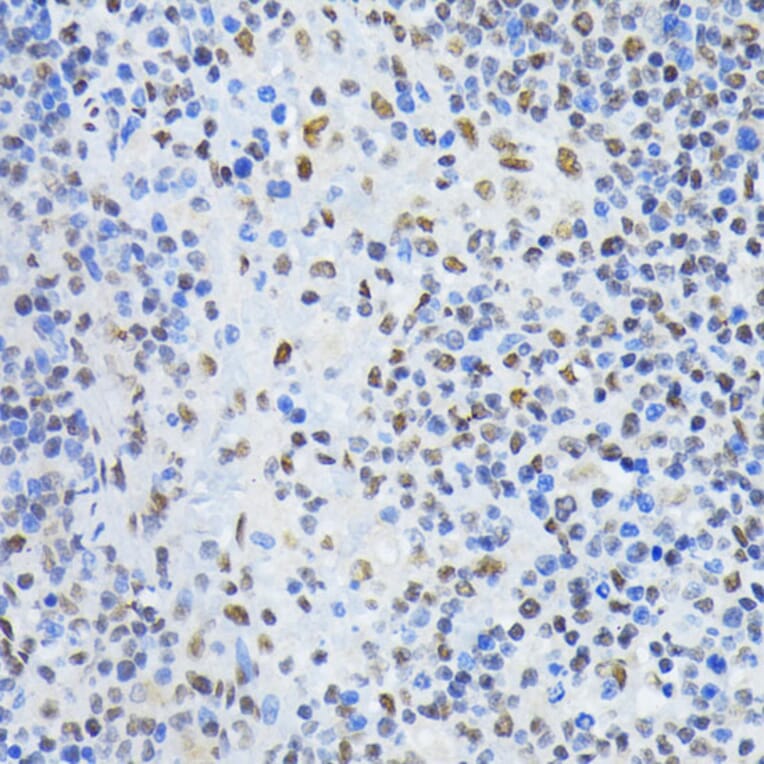 Immunohistochemistry - Anti-PTBP1 Antibody (A13686) - Antibodies.com