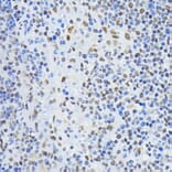 Immunohistochemistry - Anti-PTBP1 Antibody (A13686) - Antibodies.com