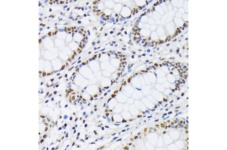 Immunohistochemistry - Anti-PTBP1 Antibody (A13686) - Antibodies.com