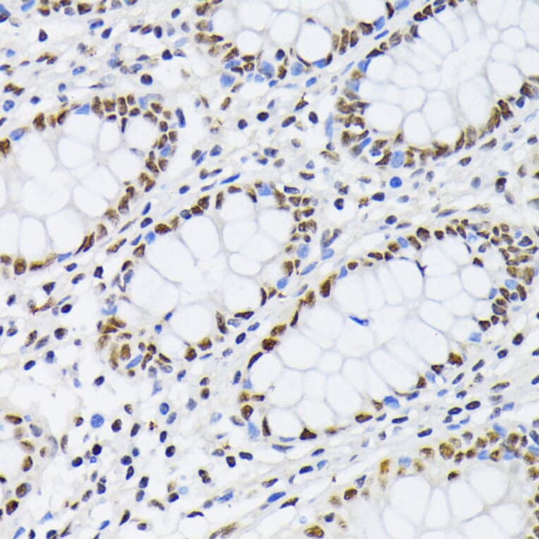 Immunohistochemistry - Anti-PTBP1 Antibody (A13686) - Antibodies.com