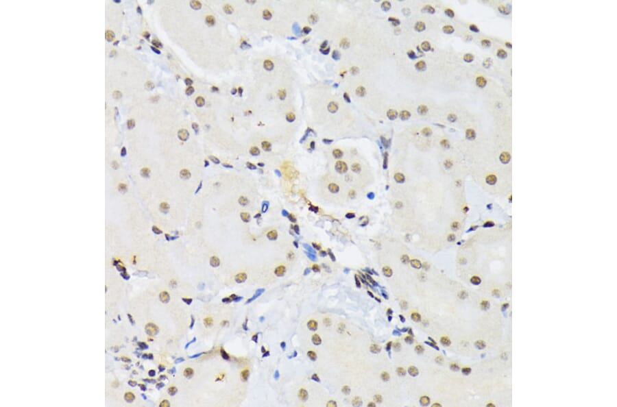 Immunohistochemistry - Anti-PTBP1 Antibody (A13686) - Antibodies.com