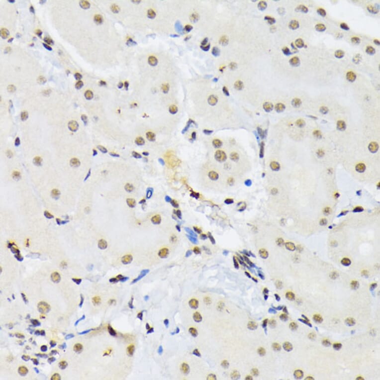 Immunohistochemistry - Anti-PTBP1 Antibody (A13686) - Antibodies.com