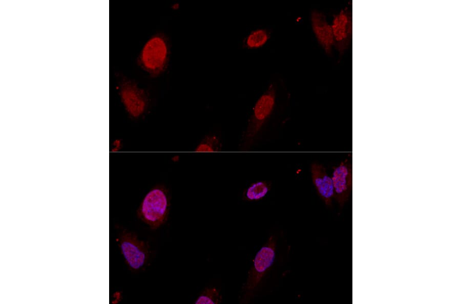 Immunofluorescence - Anti-PTBP1 Antibody (A13686) - Antibodies.com
